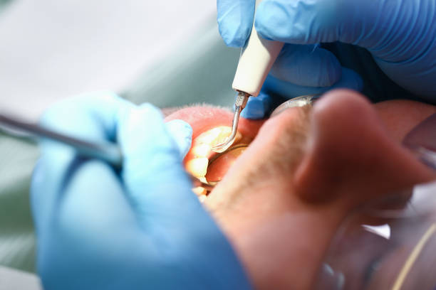 Best Broken or Cracked Tooth Emergency Dentist in Eagle Point, AL